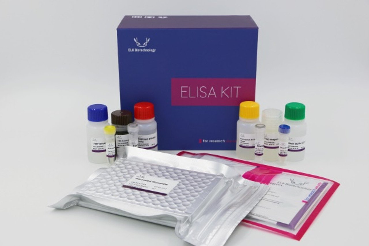 Human IgA(Immunoglobulin A) ELISA Kit